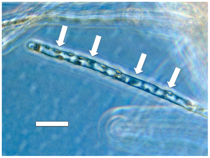 Figure 14