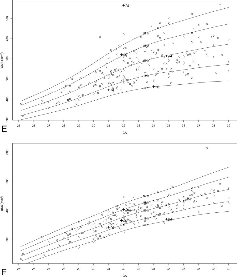 Fig 2.