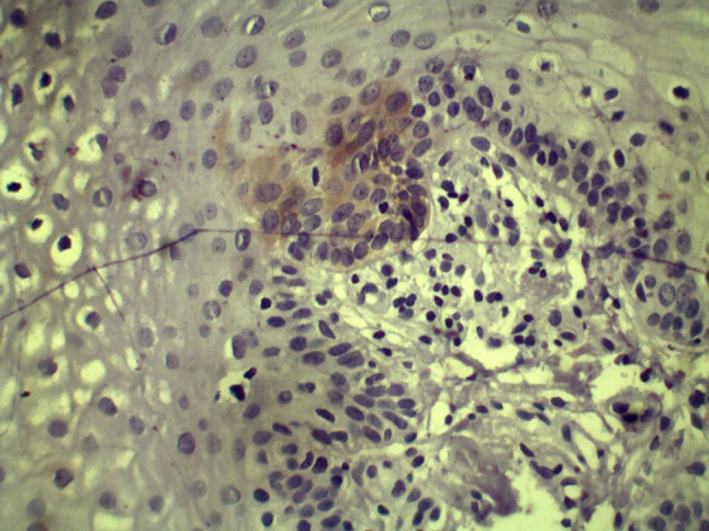 Fig. 13