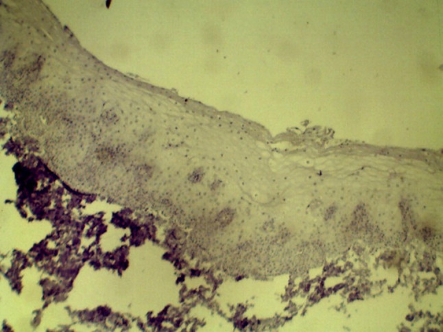 Fig. 11