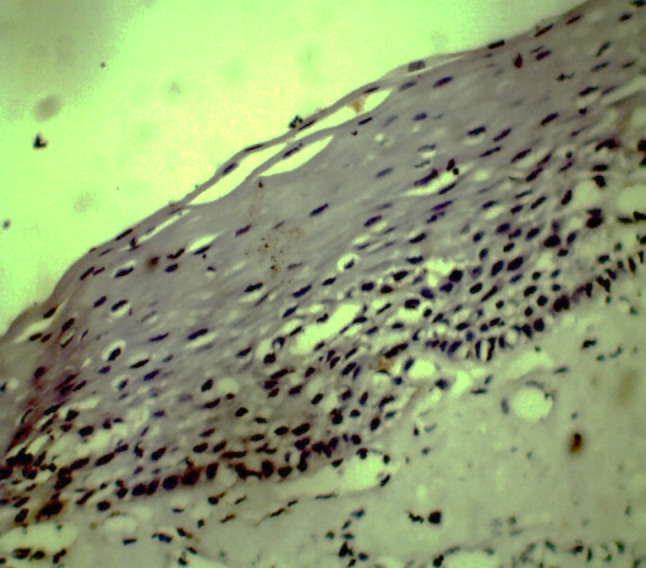 Fig. 14