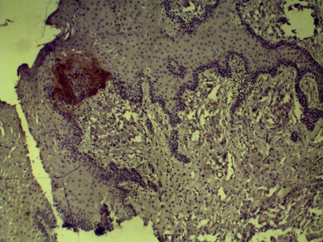 Fig. 18
