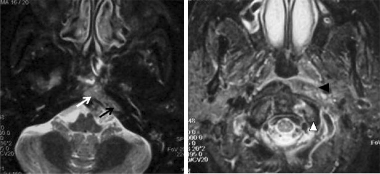 Fig. 2