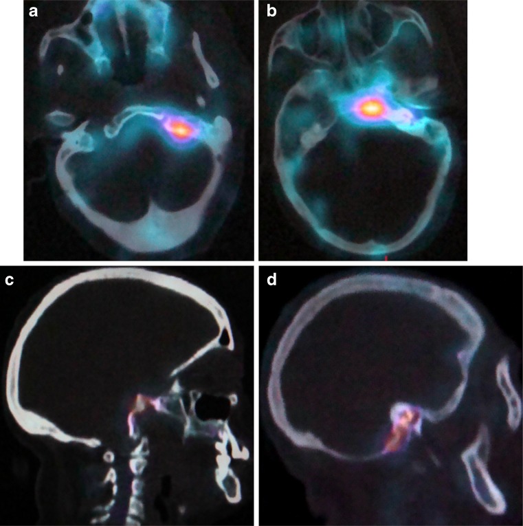 Fig. 6