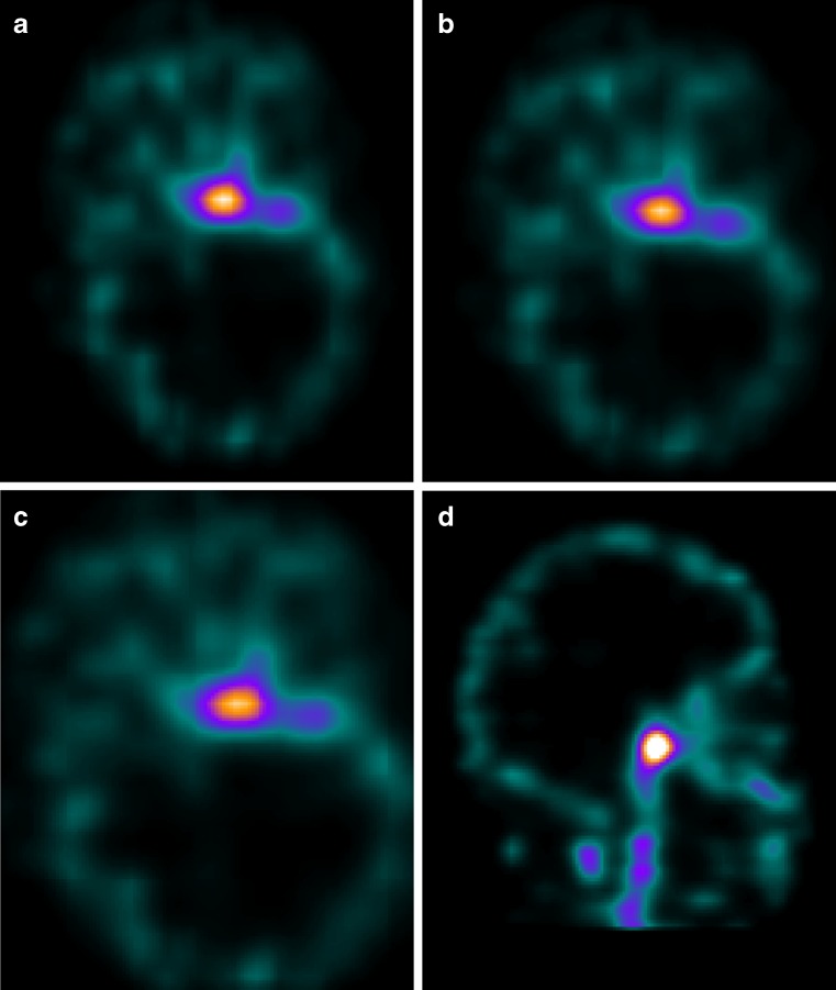 Fig. 5