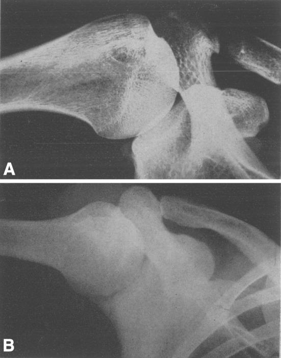 Fig. 1A–B