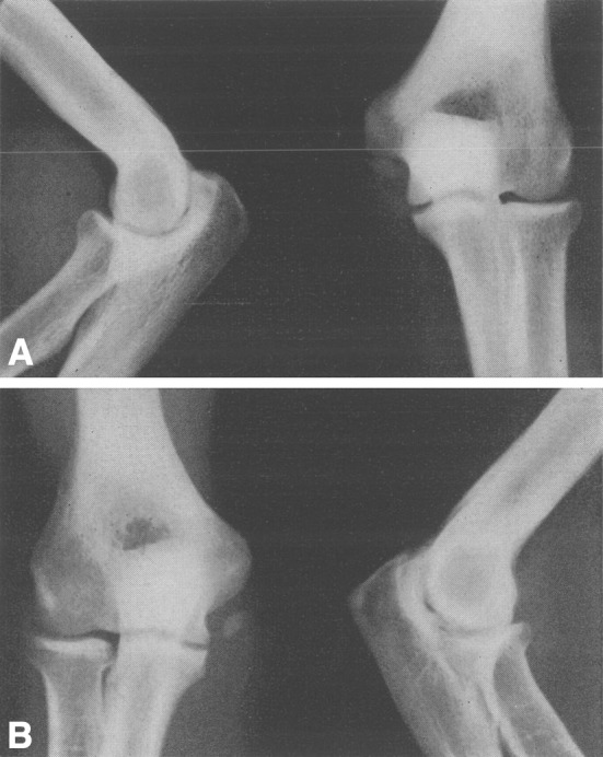 Fig. 2A–B