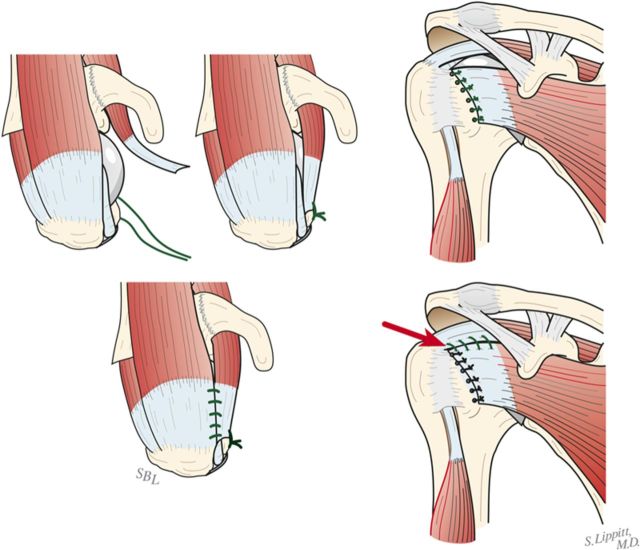 Fig. 7-G