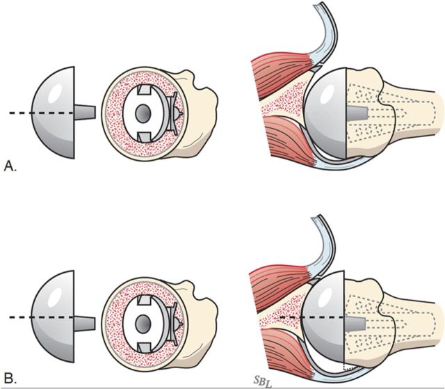 Fig. 7-F