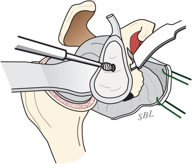 Fig. 6-G