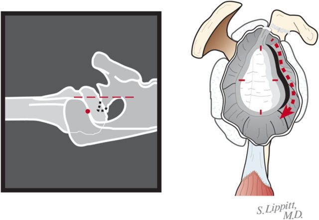 Fig. 6-B