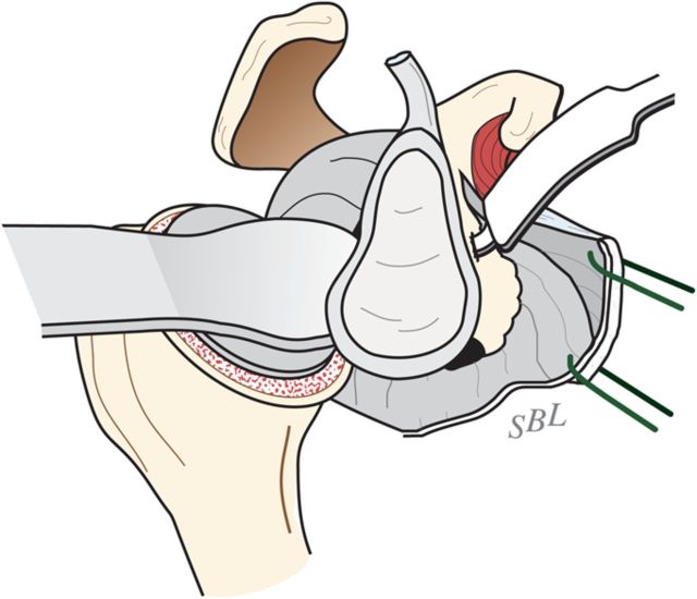 Fig. 6-A