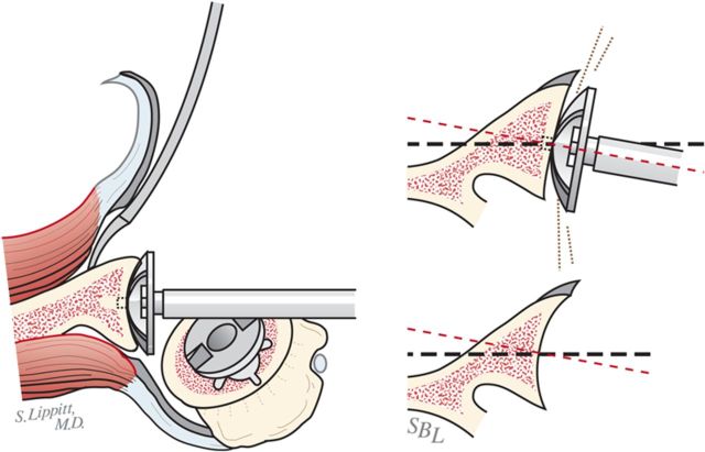 Fig. 6-H