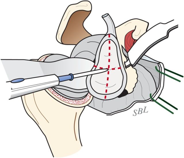 Fig. 6-F