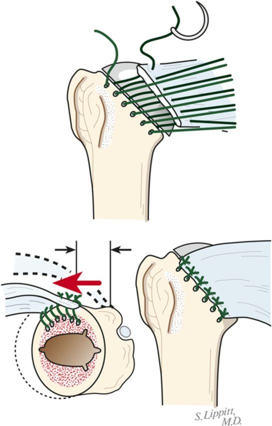 Fig. 8-B