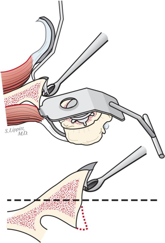 Fig. 6-D