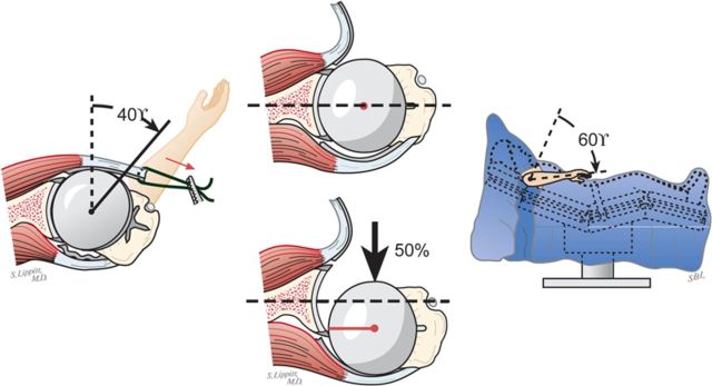 Fig. 7-A