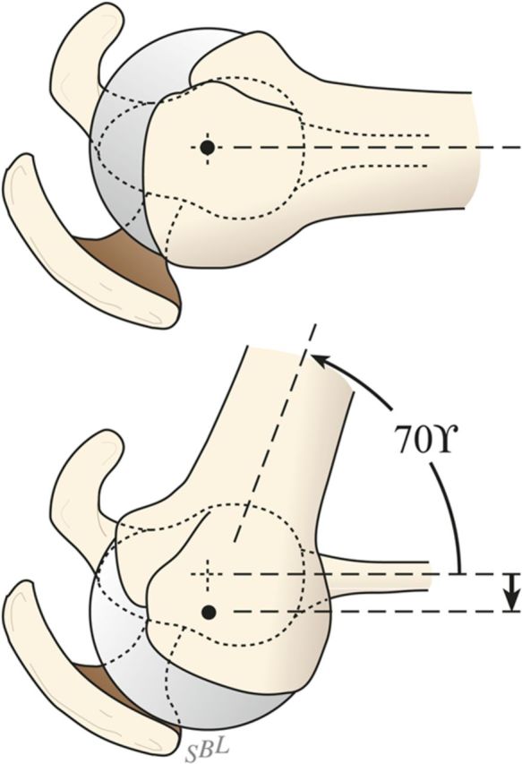 Fig. 7-E