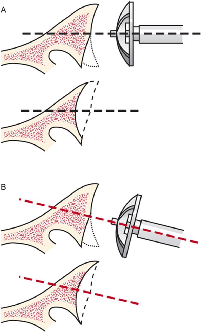 Fig. 6-J