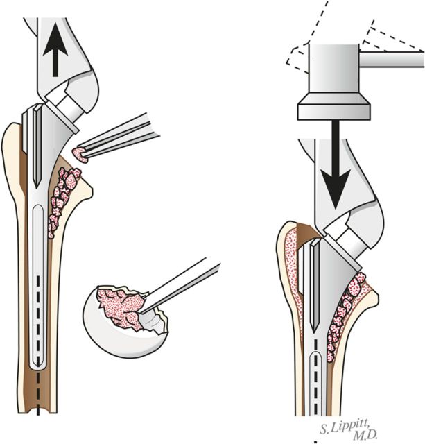 Fig. 8-A