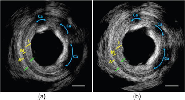 Fig. 10