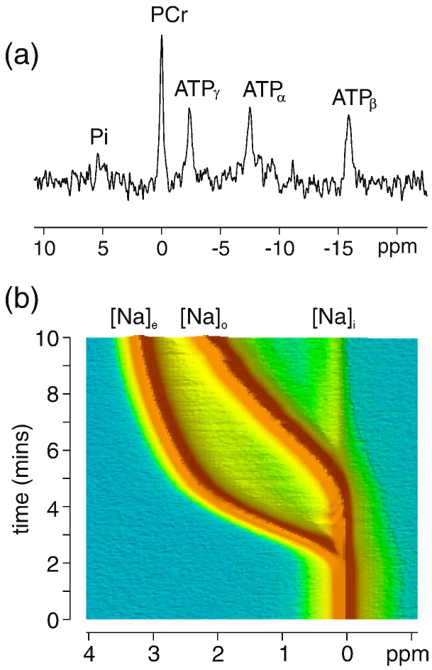 Multiple quantum filtered 23Na NMR in the Langendorff perfused mouse ...