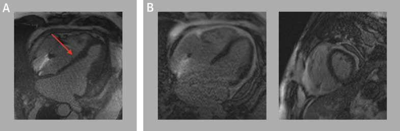 Figure 4