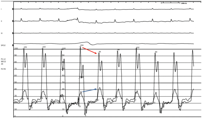 Figure 3