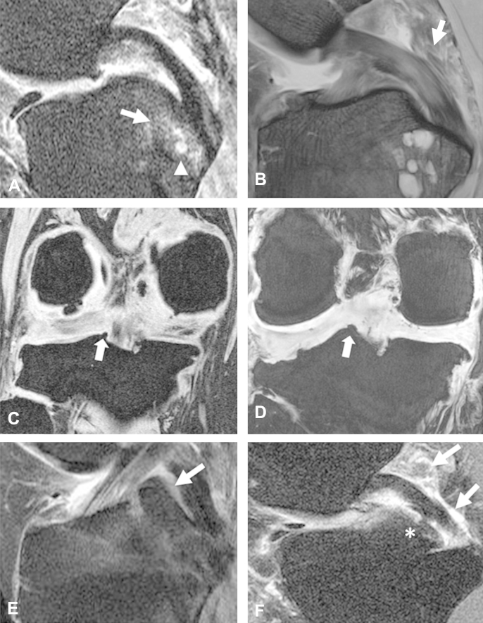 Fig. 5