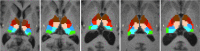 Fig. 5