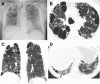 Fig. 20