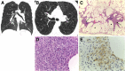 Fig. 11