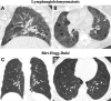 Fig. 14