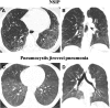 Fig. 18