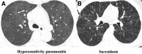 Fig. 17