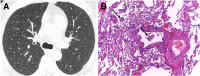 Fig. 15