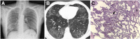 Fig. 16