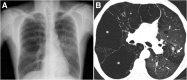 Fig. 8