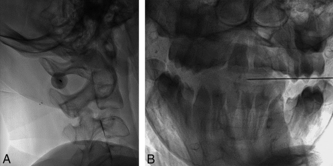 Fig 4.