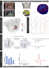 Sketch of the computational pipeline. We reconstruct the patient-specific geometry with HLHS from imaging. We generate a dataset of electrophysiology simulations encompassing cell-to-organ variability in model parameters