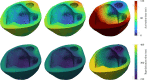 Running in silico disease scenarios. Activation (top) and repolarization (bottom) maps with personalized model parameters (left), left bundle branch block (centre) and right bundle branch block (right).