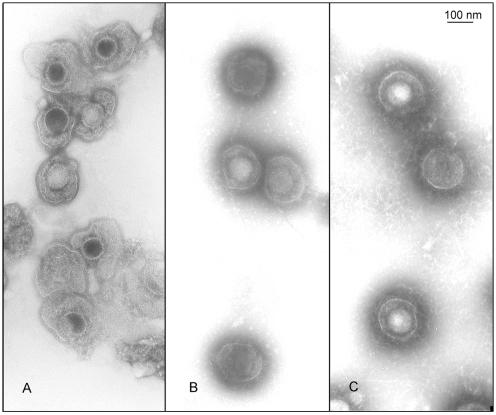 FIG. 11