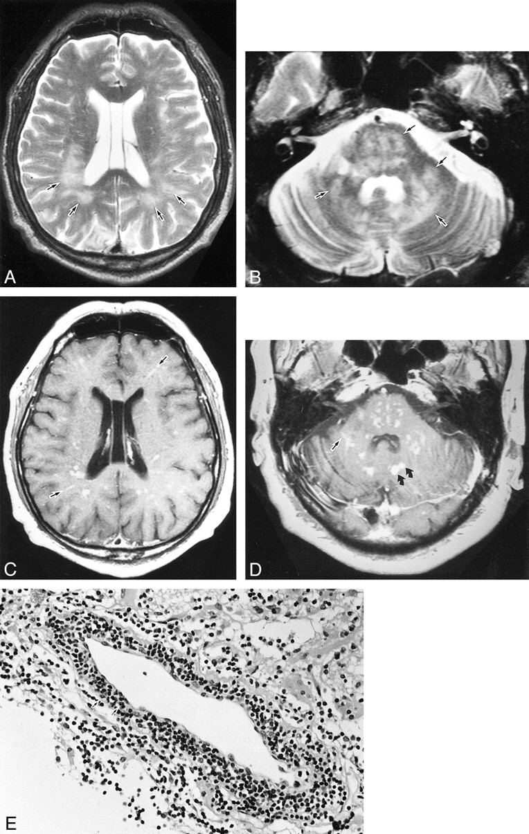 fig 2.