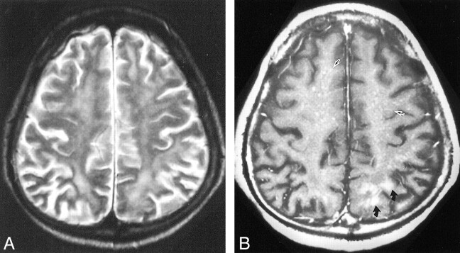 fig 3.