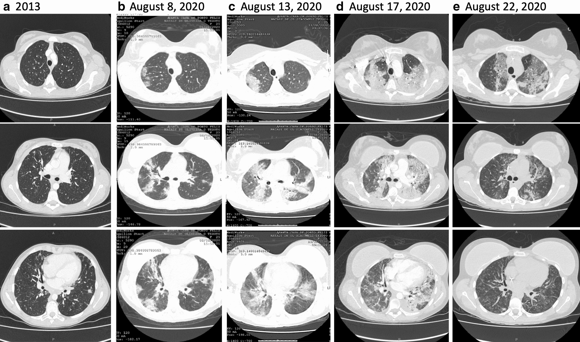 Fig. 1