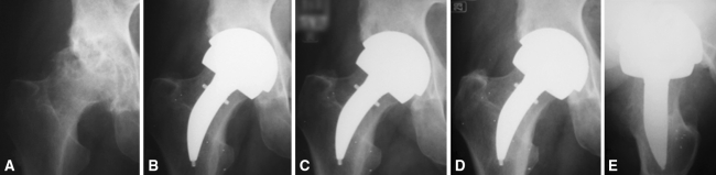 Fig. 6A–E