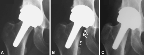 Fig. 5A–C