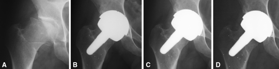 Fig. 7A–D