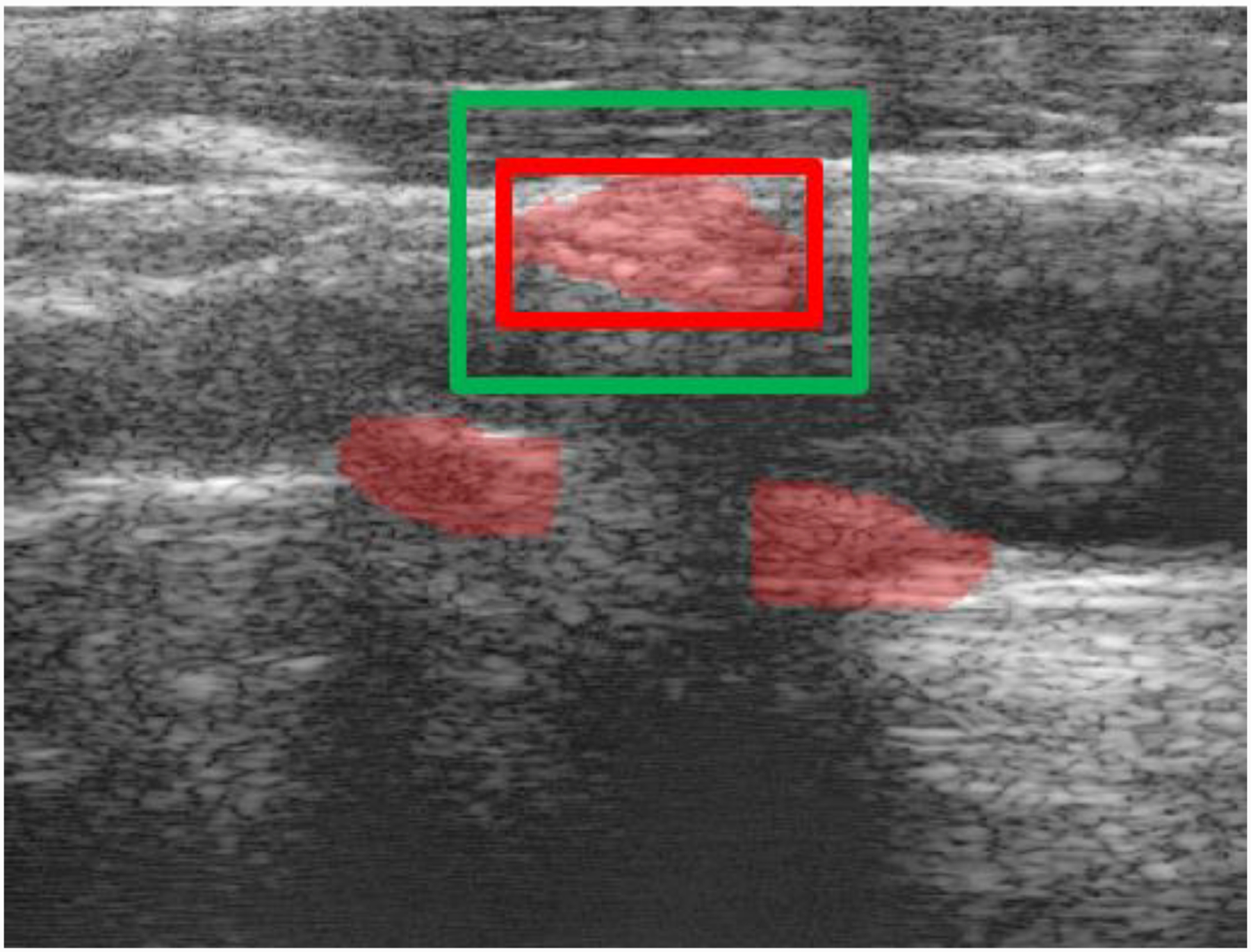 Figure 2: