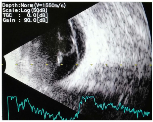 Figure 5.